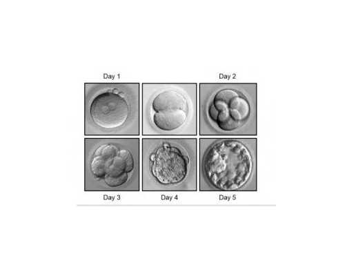 武汉怎么找代孕试管,2023年武汉哪家公立医院做三代试管比较好？