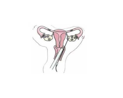 武汉代怀医院费用,武汉供卵试管助孕,武汉试管供卵公司