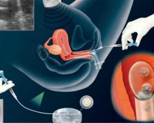 武汉地下供卵,武汉地下供卵试管医院简介