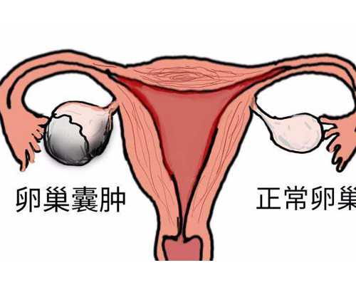武汉有想做代怀的吗,武汉代怀孕捐卵女孩