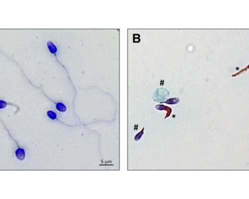 代生技术~空腹胰岛素高可以怀孕吗