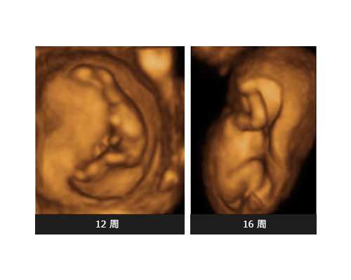 武汉买卵,武汉买卵