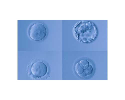 igm和igg哪个影响怀孕？2023赠你igm和igg的区别