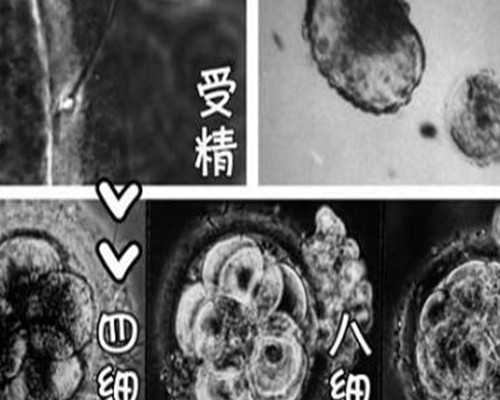 支原体阳性做试管：有没有支原体阳性做试管成功了的案例