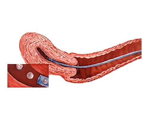 武汉供卵试管找哪个医院,武汉有哪些供卵试管婴儿医院？