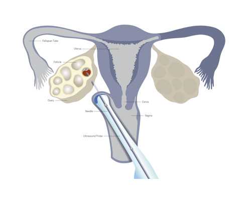 武汉同性供卵试管,武汉供卵三代试管的工作原理