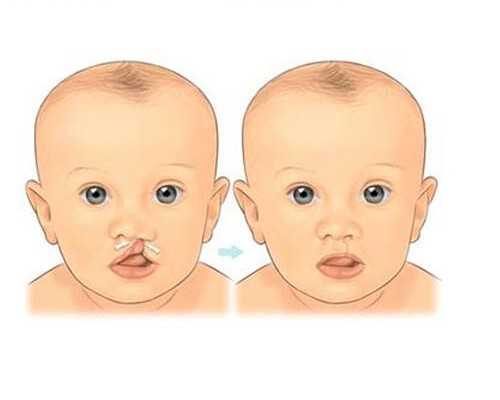 阴超什么时候做最精准？月经前两周时间