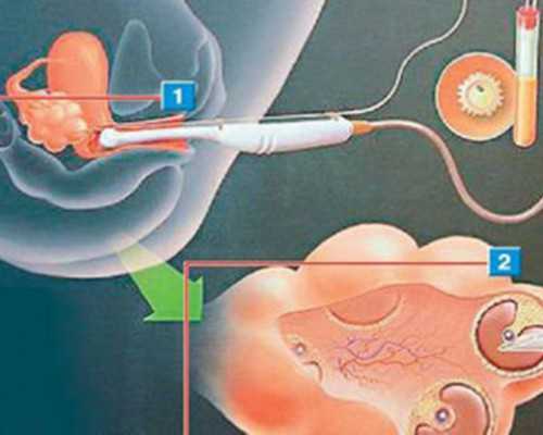 武汉代孕私立医院,武汉试管婴儿只问v3武汉黄浦