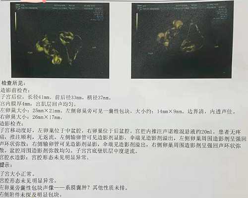 武汉三代试管生育收费价目表