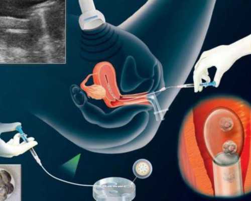 私人试管医院~子宫肌瘤有什么样的危害