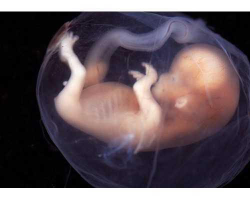 武汉助孕哪家做得好,武汉优生助孕中心