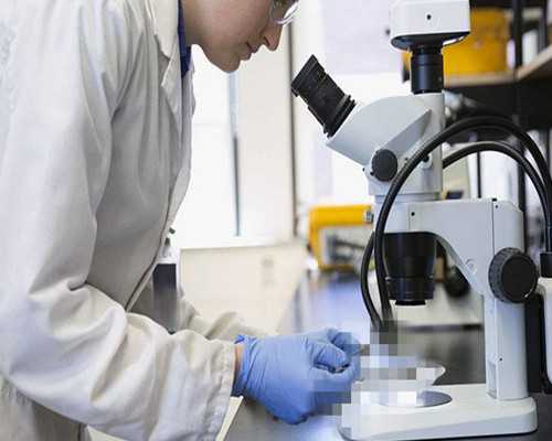 试管促排卵期间注意事项