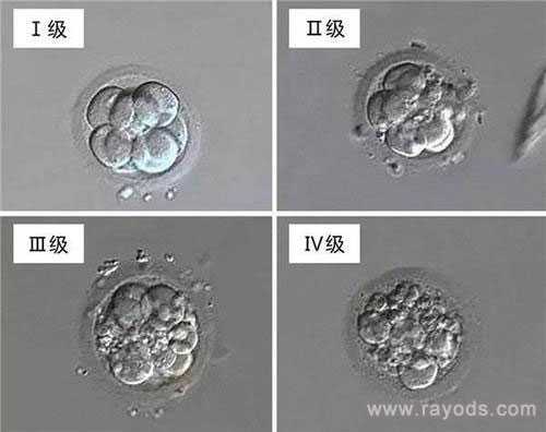 万盛试管代怀生个男孩_万盛专业代怀服务_试管胚胎等级分类，二级胚胎是不是